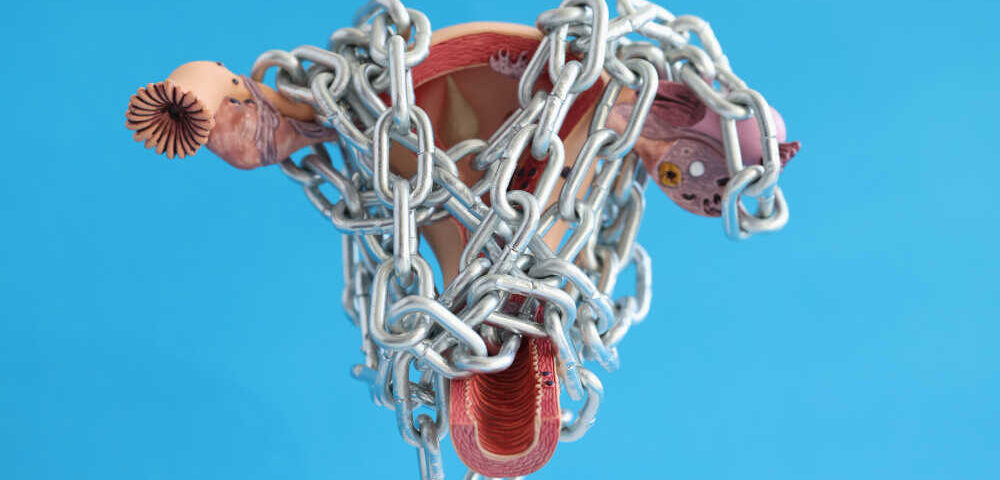 מה הם שרירנים ולמה הם גורמים